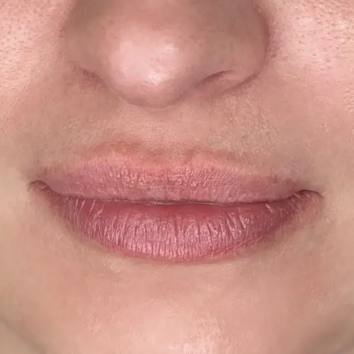 Zbliżenie na usta przed wykonaniem zabiegu makijażu permanentnego ust metodą kontur z wypełnieniem